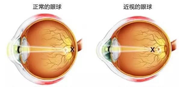 宝宝迷上了手机怎么办,宝宝迷上手机