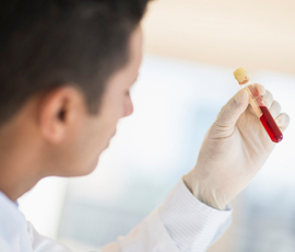 肝素保胎对复发性流产的好处,复发性流产怀孕后是否要马上保胎