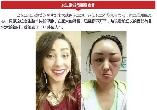 白发补染发根与染全头哪个危害大,染白发发根染黑了怎么处理