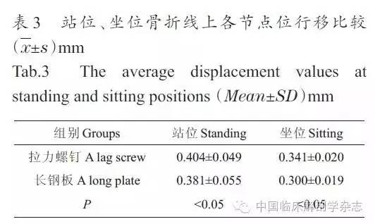 长骨骨折石膏固定术,长骨骨折夹板固定