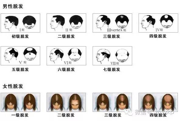 如何零成本治脱发,简单不脱发的教程
