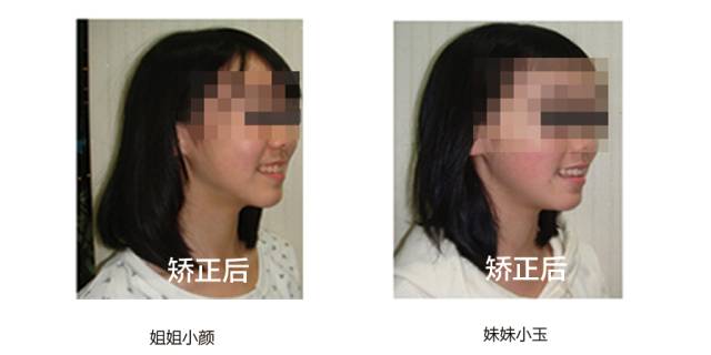 正畸专家介绍图,正畸医生关于整牙的10条建议