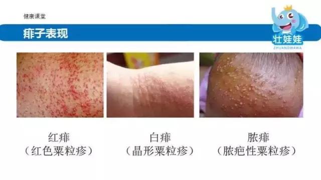 夏季常见的皮肤问题,夏季皮肤问题怎么处理