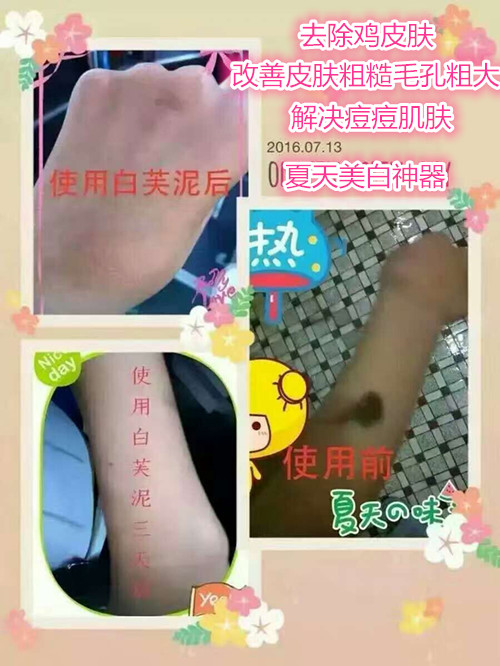 提拉紧致松弛下垂的脸部肌肤,脸松弛做什么运动能紧致肌肤