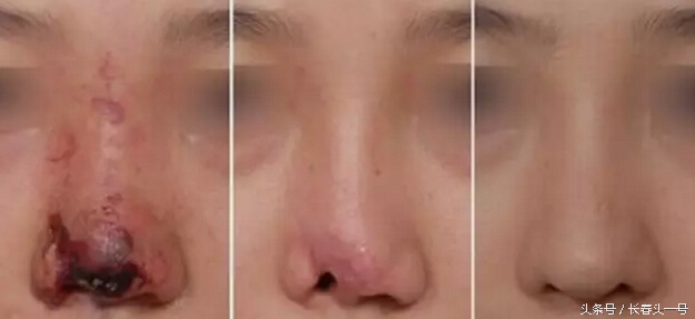 缇庝附鐒︾偣鏁村舰缇庡鍖婚櫌淇榧诲瓙,缇庝附鑱氱劍