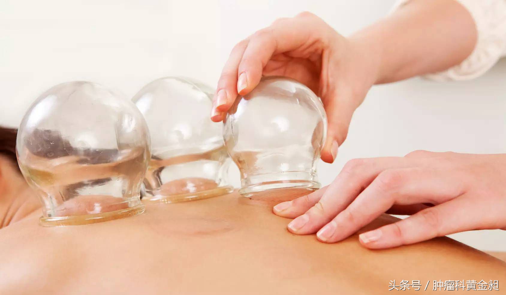 头部刺血拔罐不出血,刺血拔罐用什么针出血多