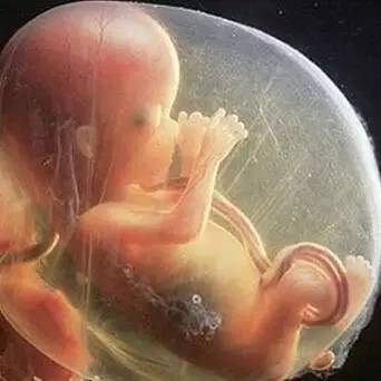 孕妇吃多了会导致婴儿变胖吗,孕妈吃多了宝宝也会撑吗