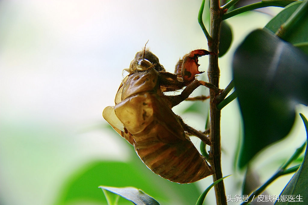 荨麻疹草药治疗法,中药治荨麻疹的最好方法