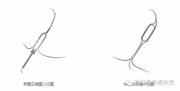 来例假用棉条可以下海游泳吗,用月经棉条可以下水游泳吗