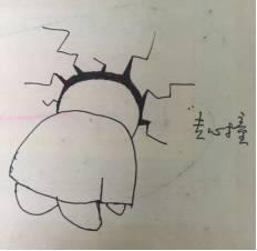 notes手术弊端,notes妇科手术模拟