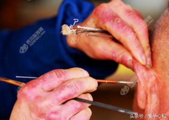 怎么用棉签给孩子掏耳朵,小朋友可以用棉签掏耳朵吗