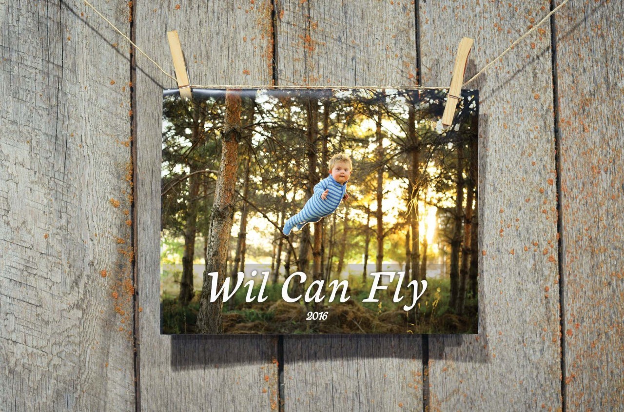 小孩患唐氏综合征,唐氏综合征比较幸运的孩子