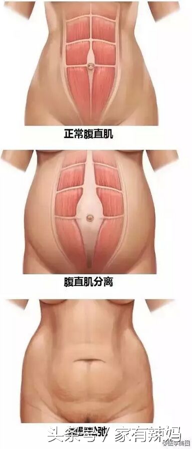 产后瘦身运动完整版,产后瘦身视频完整教程