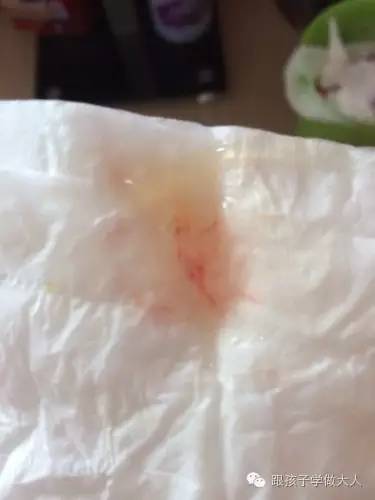 孕晚期出现哪几种症状预示要生,孕晚期孩子要出生会有前兆吗