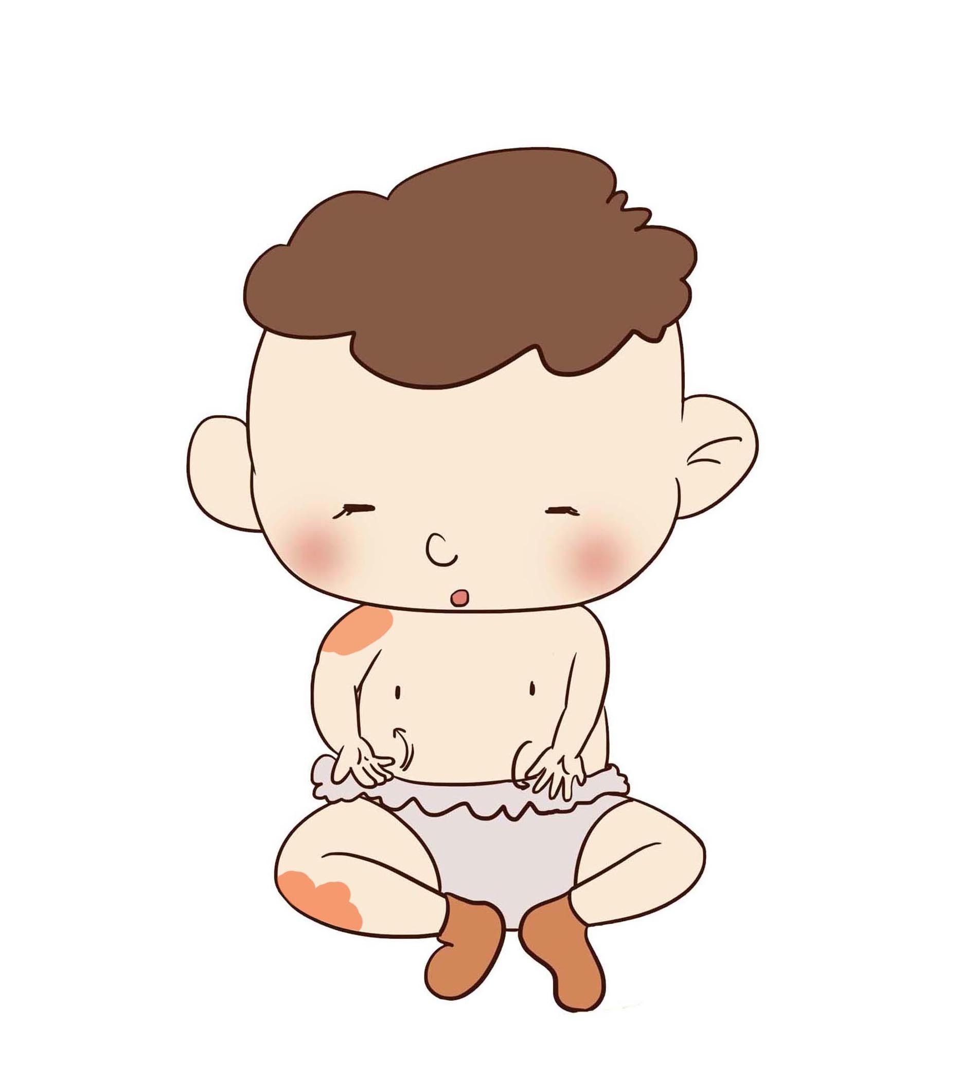 宝宝哪些胎记需要警惕,胎记治疗要趁早