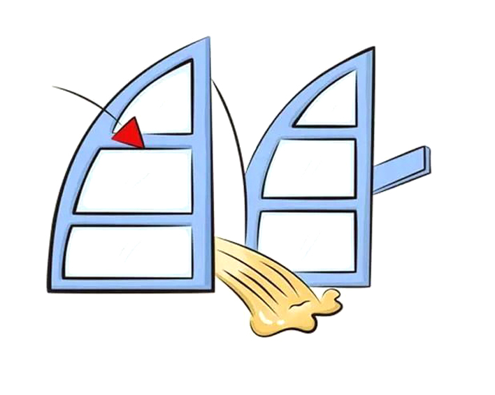 肠痉挛发作身旁没有药物怎么办,肠痉挛直不起来腰怎么办