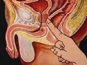 阑尾术后大便稀正常吗,阑尾术后一周大便出血