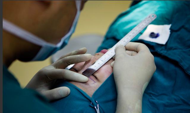 为什么大家都喜欢大眼睛双眼皮,为什么大家喜欢做双眼皮手术