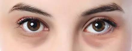 眼周有细纹用什么眼霜,护理眼周先用眼精华还是先用眼霜