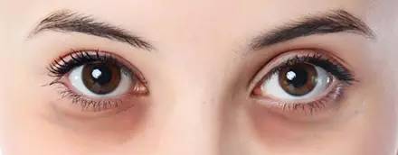 眼周有细纹用什么眼霜,护理眼周先用眼精华还是先用眼霜