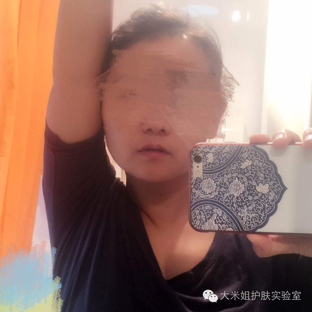 美白祛斑真的有科学依据吗,美白祛斑的原理