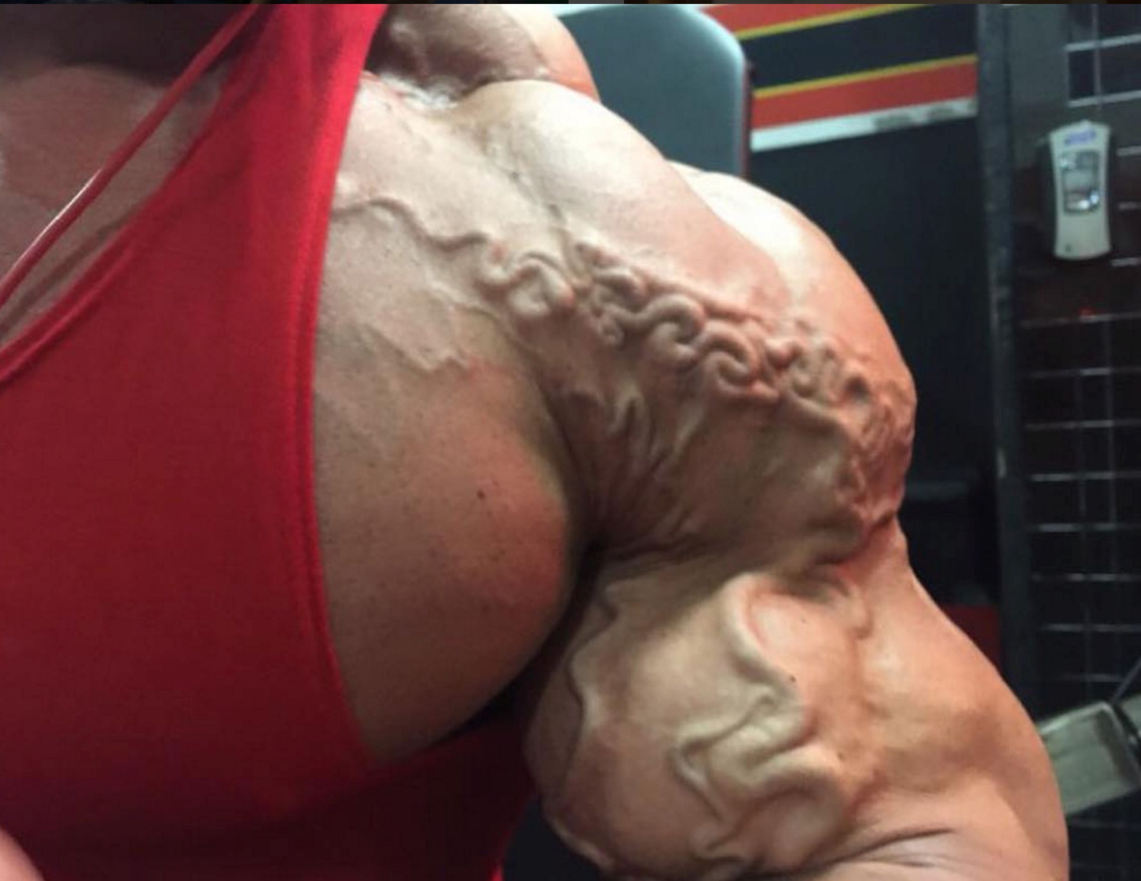 健身身上爆出来的是青筋还是血管,为什么健身的人都青筋暴起