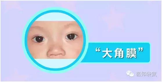 儿童医院专家告诉你：宝宝流眼泪、长眼屎的真相