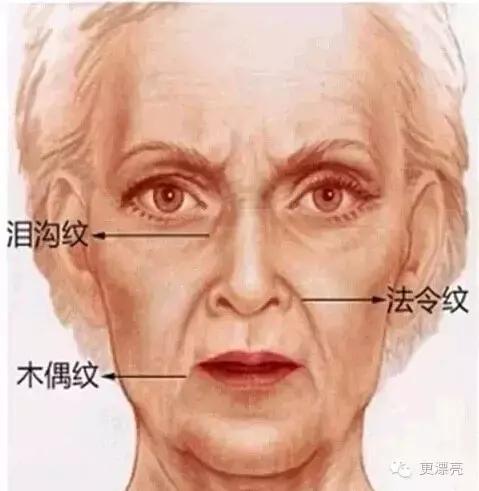 爱笑的女孩只有法令纹,果然爱笑的女孩法令纹很重了