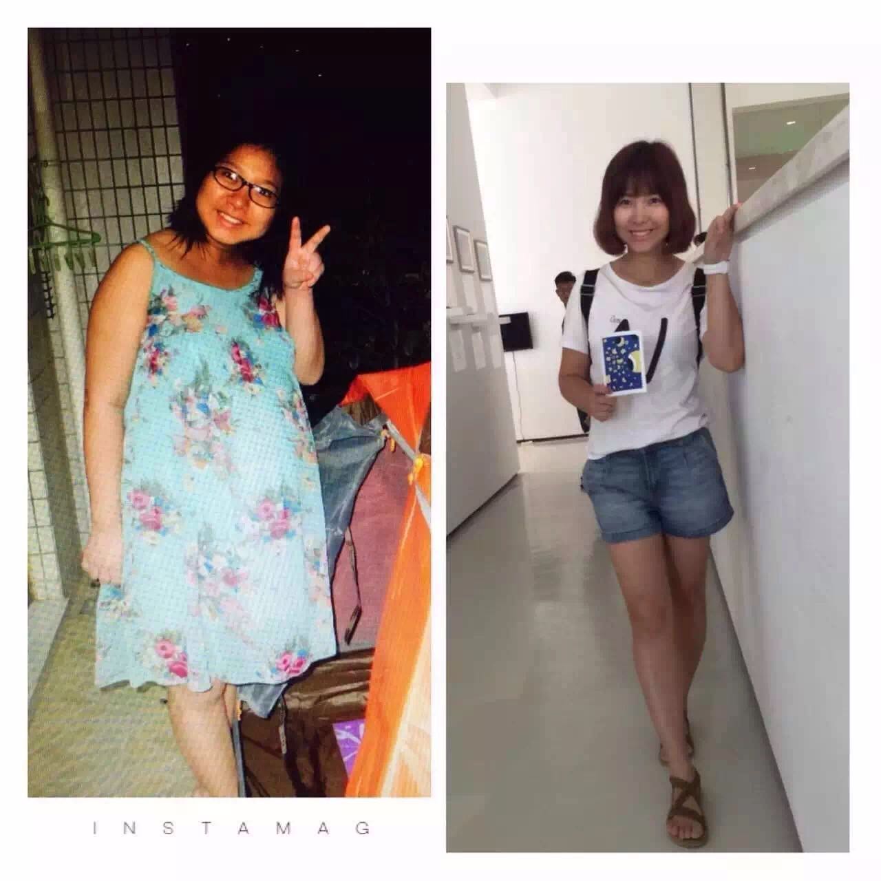 马拉松才是整形院辣妈生娃之后判若两人