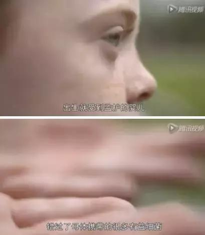 父母不过敏孩子怎么会过敏,皮肤过敏怎么治反复过敏