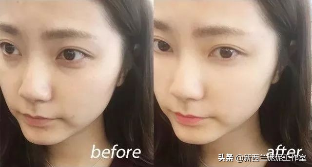 吴昕同款祛黄脸,吴昕眼袋