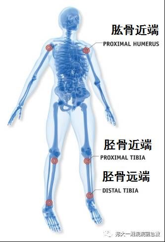 如何提高静脉输液速度的准确率,输液疗法是怎么发明的