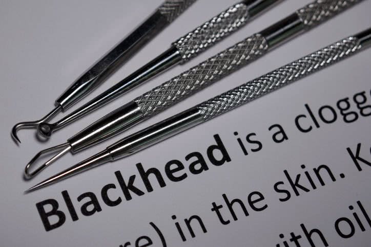 用黑头针去黑头的正确方法,去黑头的针正确护理方法