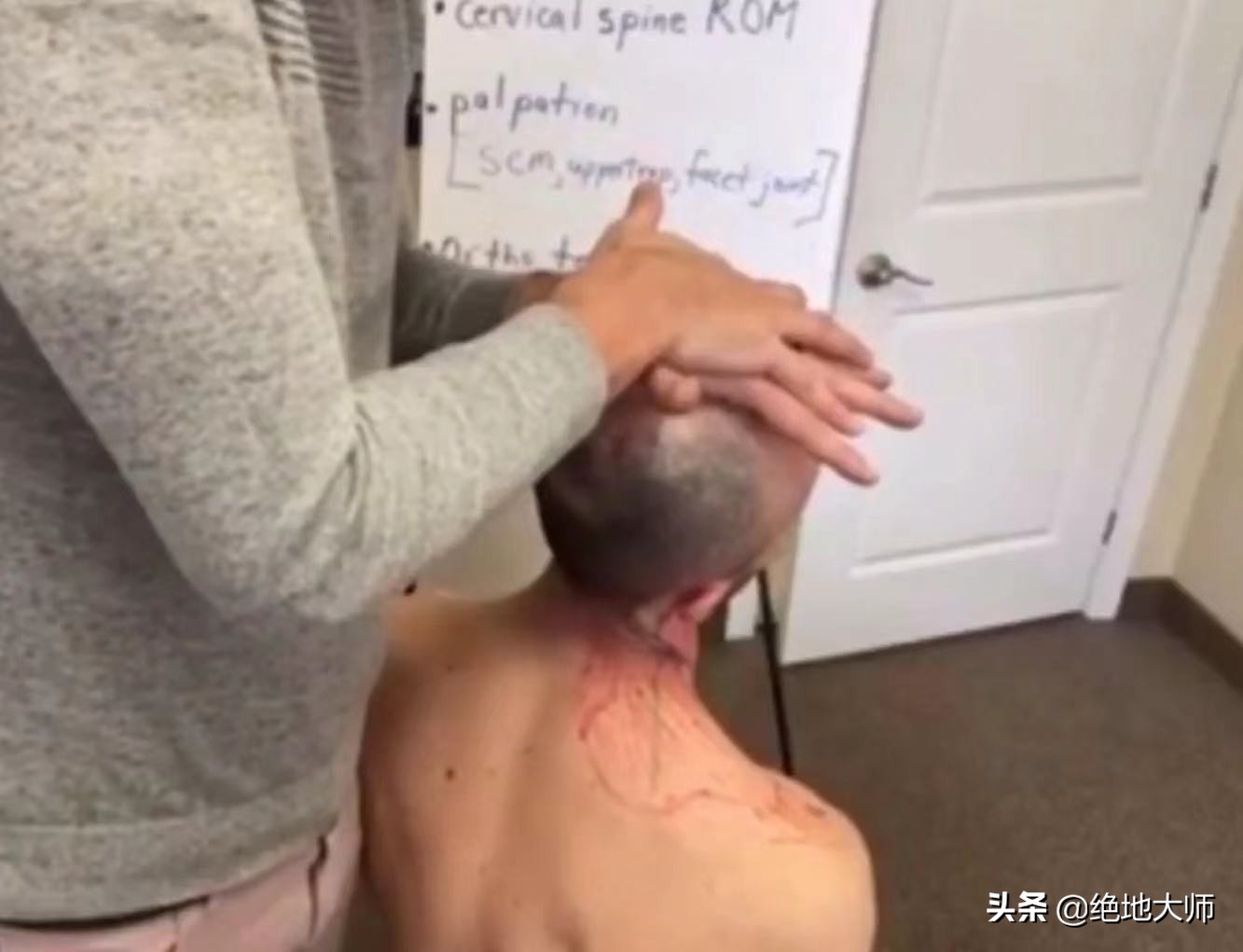 急性颈痛的神经调控康复治疗