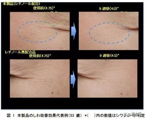 国际品牌去皱眼霜去细纹鱼尾纹,哪种眼霜去皱淡化黑眼圈效果好