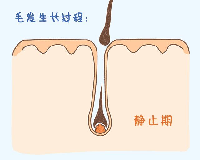 雄性激素脱发怎么自救,自救脱发最有效的方法
