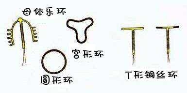 常用且有效的避孕方式是什么,详细介绍各种常见的靠谱避孕方式