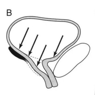 生完孩子盆底恢复不好会漏尿吗,盆底康复治疗漏尿有效果吗