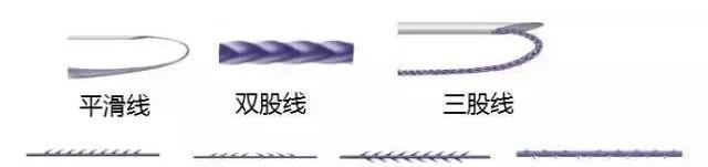 线雕是面部提升最好的方法吗,面部提升最好的方法是线雕吗