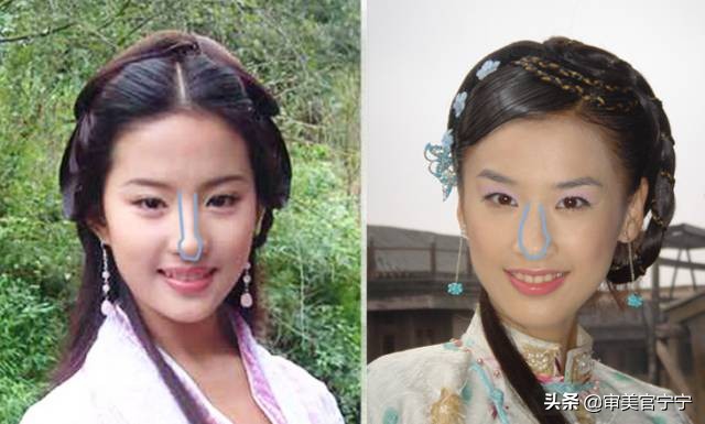 鼻子宽大眼距过近,鼻子宽度大于眼间距原因