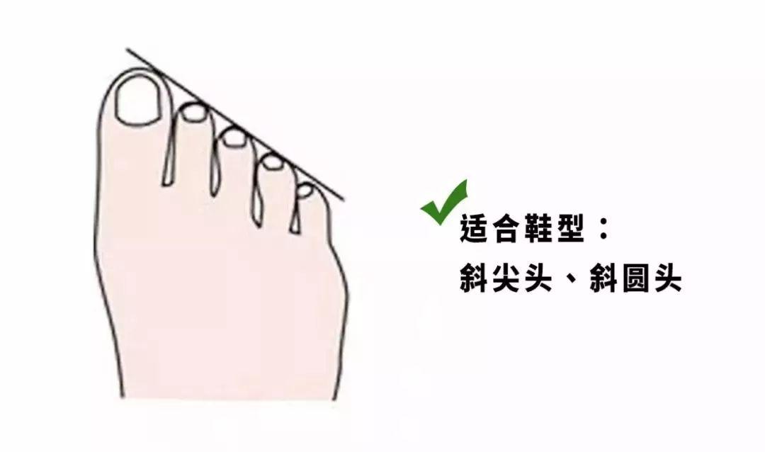 怎样选适合脚型的鞋子,找到一双显脚型好看的鞋子