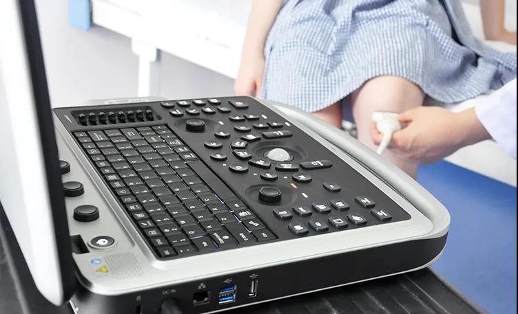 祥生ivis50超声机,祥生医疗超声行业领先