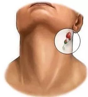 孩子长疹子、痰火核用不用吃药？