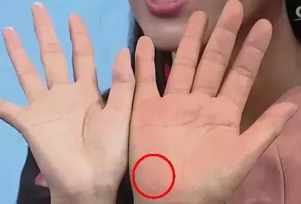 10种常见病对照表,100种常见病诊断