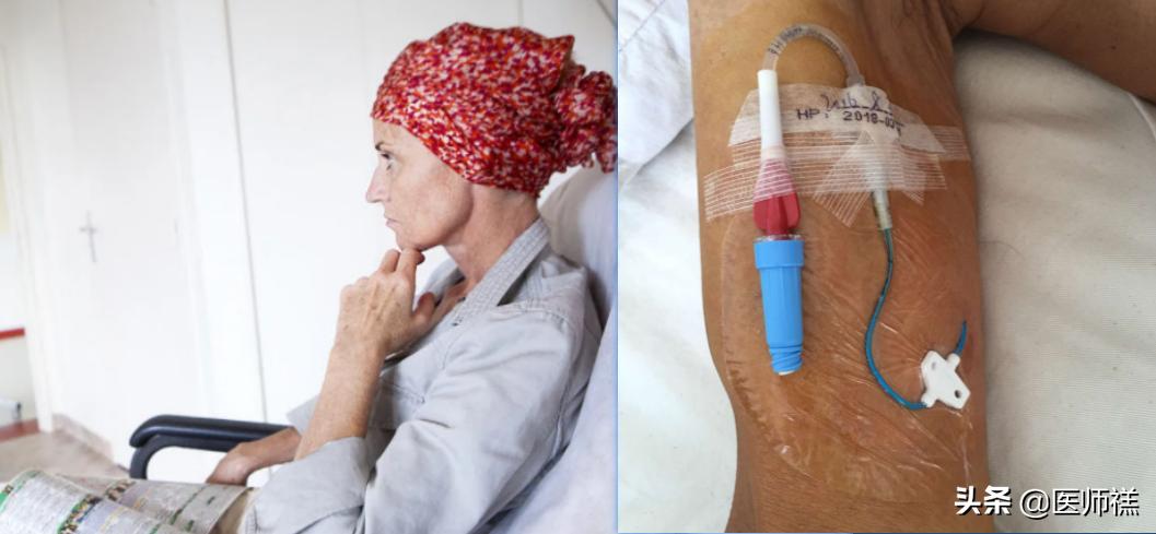 化疗呕吐处方药,化疗药物引起的恶心呕吐的科普