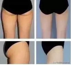 为什么女人的屁股要常拍？