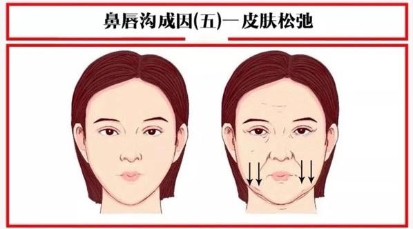 关于法令纹的冷知识,关于法令纹的误解你中招了吗