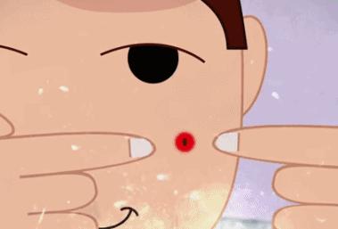 激光美容时遇到睑缘肿物，用激光和手术切除有啥区别？