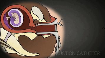 妈妈我是从哪里来的原视频作者,妈妈我是从哪里来的呀配音