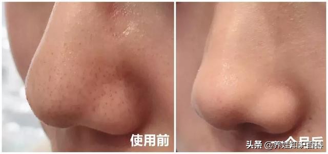 天天熬夜带娃瘦了,天天熬夜带娃也不见瘦